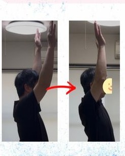施術前後の肩の可動域の変化(ビフォーアフター)