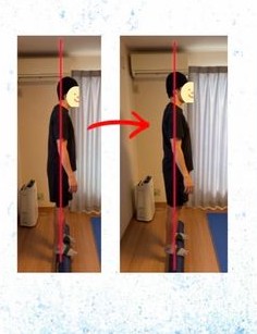 施術前後の立ち姿勢の変化(ビフォーアフター)